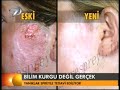 Op. Dr. Tunç T?RYAK? -Yan?k Tedavisi Op. Dr. Tunç T?RYAK? -Yan?k Tedavisi
