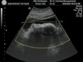 4D Ultrasound 32 Weeks Part 1