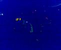 Kapten R�d - Ensamh�llet / Enkel Man @ Mosebacke