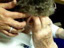 Putting the Hearing Aid Earmold in Your Ear