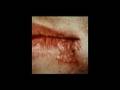 Cold sore cures and home remedies