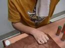beike-travis-ashtons-stem-cell-experience.html