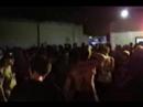 Lobotomia no Barra mansa Hard Core Lobotomia no Barra mansa Hard Core