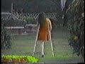 evelinda on crutches2