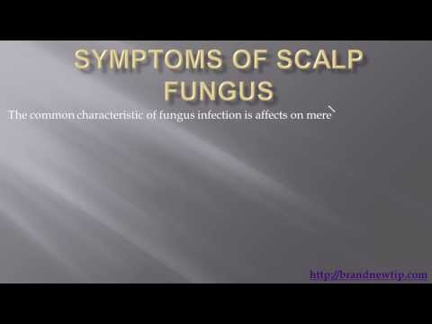 how to kill a fungus on the scalp