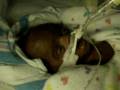 Xavier, Preemie born at 23 weeks 5days