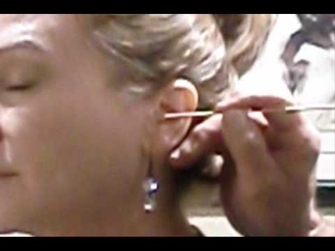 Dr Dowe explains Acupressure and Acupuncture for Weight Loss & Addictions