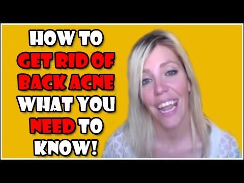 how to get rid of back acne in a week