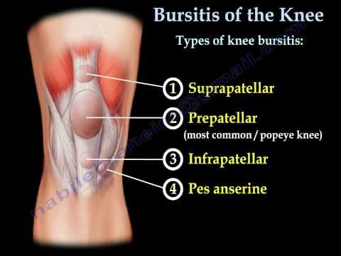 how to drain bursa sac