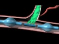 New Cancer Treatment from Vascular Designs