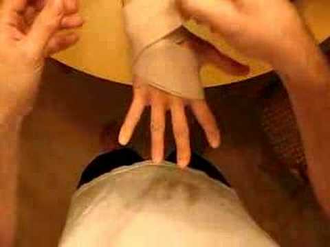 how to locate a dislocated wrist
