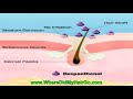 How to Make Minoxidil (Rogaine) More Effective How to Make Minoxidil (Rogaine) More Effective