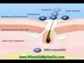How to Make Minoxidil (Rogaine) More Effective