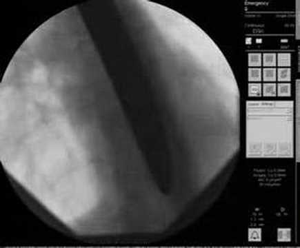 Sword swallowing X Ray - Dai Andrews ...