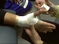Prevention an treatment Of Sports Injuries 2.2 Prevention an treatment Of Sports Injuries 2.2