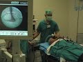Intubation with Bonfils fiberscope under general anesthesia Intubation with Bonfils fiberscope under general anesthesia