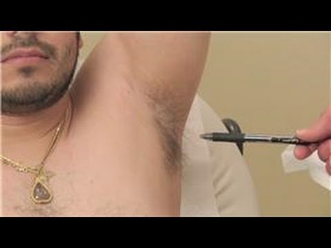 how to cure underarm sweating