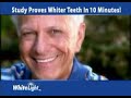 WhiteLight Teeth Whitening System