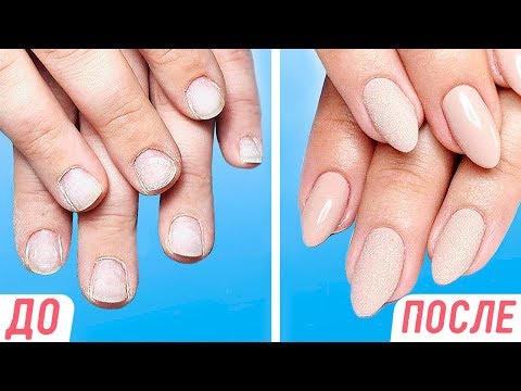 Маникюр как отрастить быстро ногти