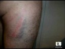 Dos Transportistas Denuncian que los Mossos les Dan Paliza Dos Transportistas Denuncian que los Mossos les Dan Paliza