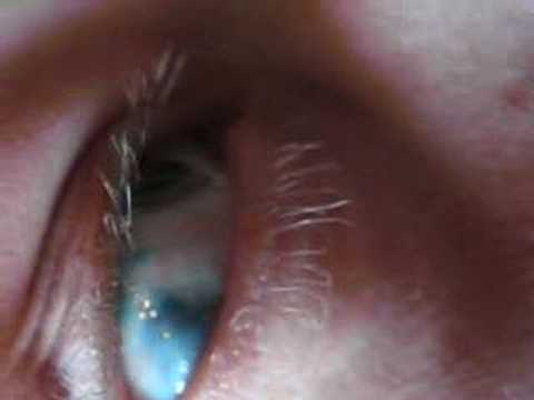 Shannon Larratt's eyeball tattoo, done by Howie (lunacobra.net).