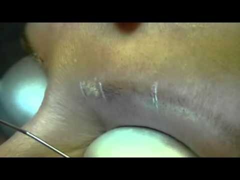 Image de prévisualisation YouTube