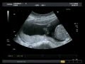videos de MALENA LAGUNA