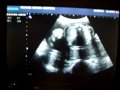 Pregnancy 泰然的妹妹_28weeks