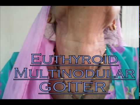 how to cure euthyroid