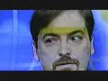Does Chuck Todd have Pink Eye? Does Chuck Todd have Pink Eye?