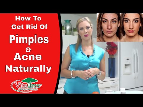 how to treat rosacea naturally