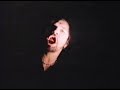 prong-snap-your-fingers-snap-your-neck.html