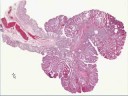 Medical School Pathology, Chapter 7a