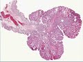 Medical School Pathology, Chapter 7a 3