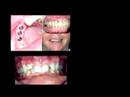 what is a prosthodontist? what is a prosthodontist?