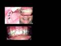 what is a prosthodontist?