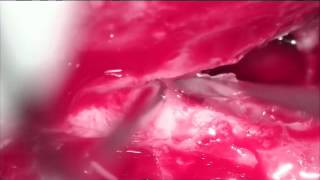Placido Ostos Aumente-10