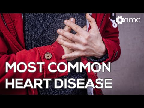 how to treat ischaemic heart disease