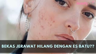 youtube:CnqB55Lxnpc
