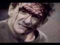 fetal dropkick - REVOLUSION