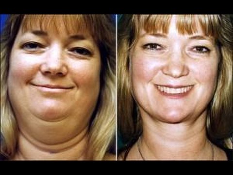 Weight loss center ocala fl photo 8