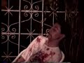 Jhonny Dasilva le tira una piedra en el ojo a Serpa Jhonny Dasilva le tira una piedra en el ojo a Serpa