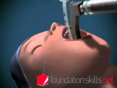 how to administer general anesthesia