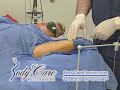 a procedure to eliminate unwanted fat...