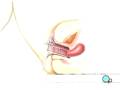 videos de Malpractice Medical Dilation and Curettage D and C Surgery 2