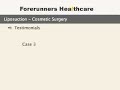 Liposuction Liposuction