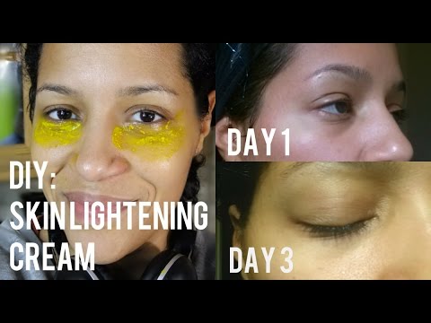 how to get rid of kool aid stains on skin
