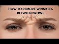 Get Rid Of Eyebrow Wrinkles