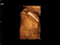 Baby Duer 2
