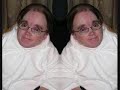 eric the midget torment 1 eric the midget torment 1